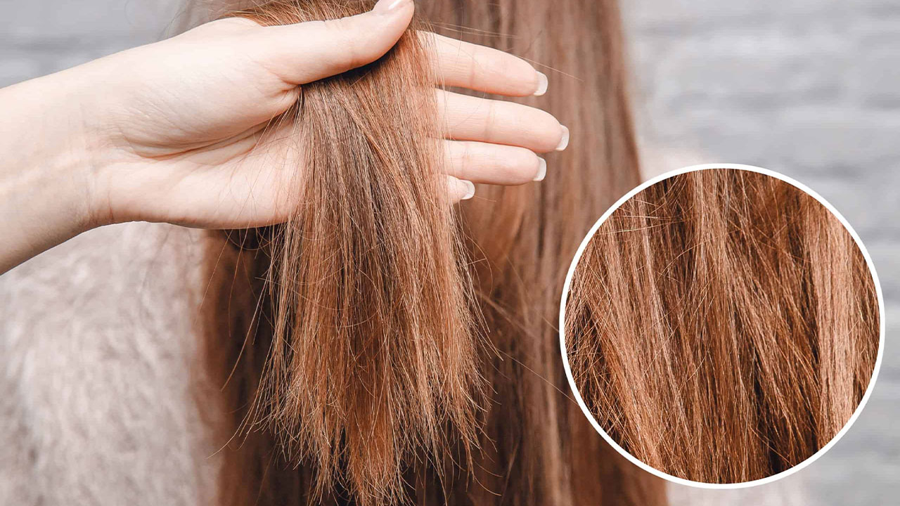 Hair damage and treatment of damaged and brittle hair2
